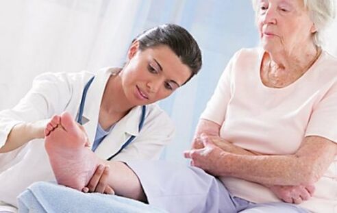 Varisli damar belirtileriniz varsa doktora görünmek